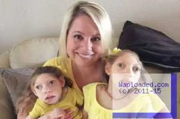 Meet Two Sisters aged 9 and 14 who Look like Babies because of Rare Condition (Photos)